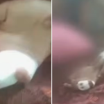 STRRAY DOG BITE