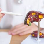liver cancer