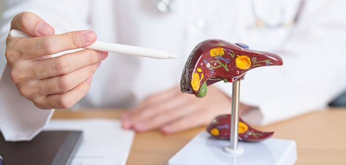 liver cancer